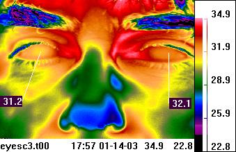 Thermal image of the
                                            face