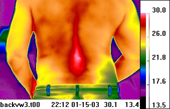 infrared image of back