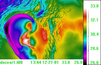 auricular / ear thermal view