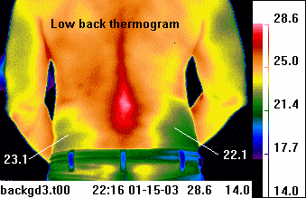Teletherm
                                                          infrared
                                                          thermal
                                                          imaging series
                                                          showing
                                                          different
                                                          human and
                                                          animal
                                                          infrared
                                                          pictures