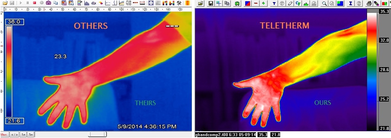 Comparing
                                                          thermal images
                                                          industrial vs
                                                          medical