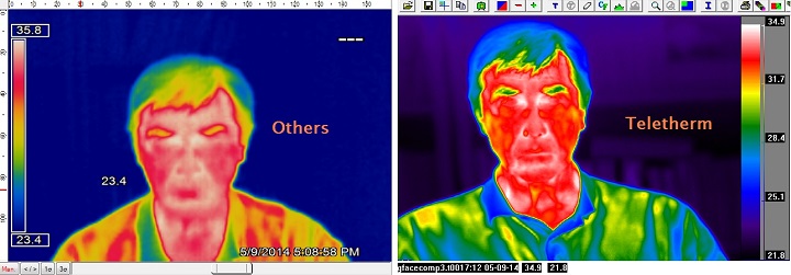 comparison







                                                          of infrared
                                                          imagers view
                                                          of face
