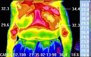 Premium Vector  Thermography of female chest thermographic image of breast
